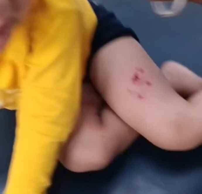 वीडियो न्यूज़ : नीमकाथाना में बंदरों का बढ़ता आतंक : बंदरों के हमले से मासूम बच्चा हुआ घायल, लोगों की स्थायी समाधान की मांग