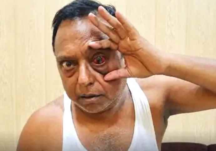 भाजपा विधायक के साथं मारपीट का मामला : जमानत मिलने पर बाहर आए एईएन की बेटी पिता के गले लगकर रोने लगी, एईएन का भाजपा विधायक पर मारपीट का आरोप