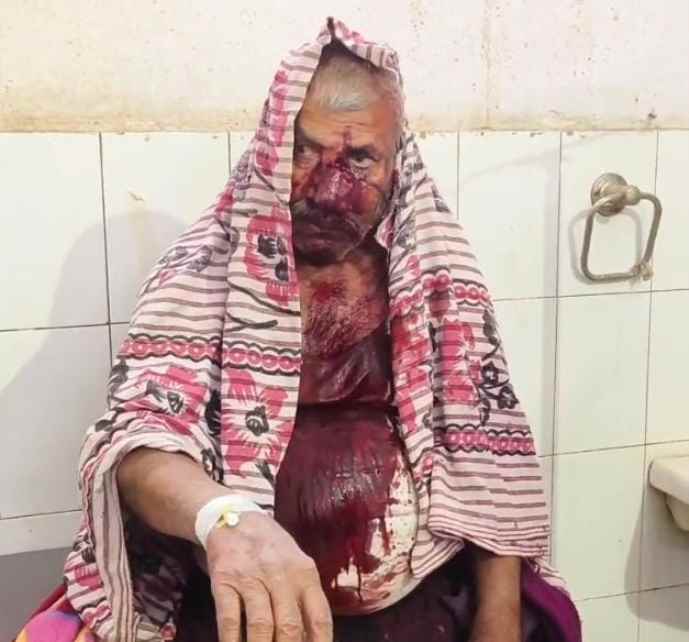 वीडियो न्यूज़ : नीमकाथाना में जमीनी विवाद में खूनी संघर्ष : लाठी-डंडों और सरियों से भीड़ गए दो पक्ष, झड़प में 3 घायल, जिला अस्पताल में भर्ती