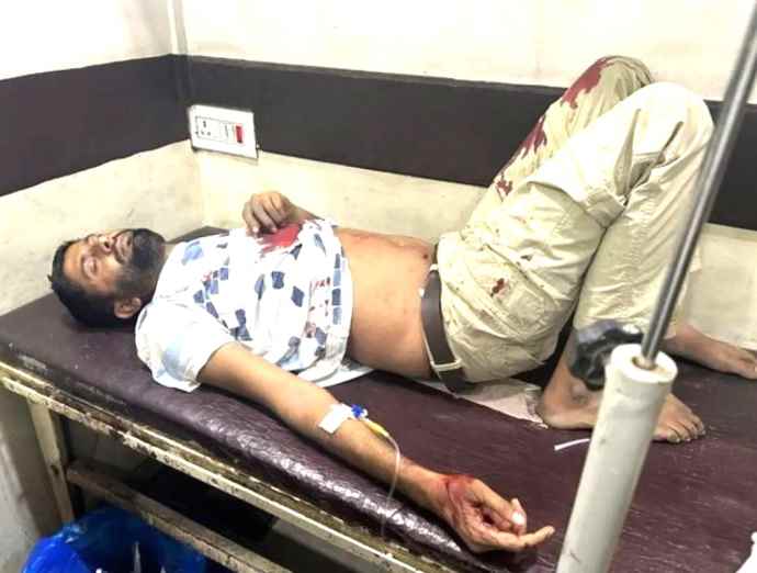 दिनदहाड़े युवक को मारी गोलियां : कार में सवार होकर आए बदमाशों ने युवक पर ताबड़तोड़ की फायरिंग, इलाके में फैली दहशत